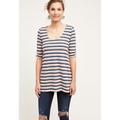 Anthropologie Tops | Anthropologie Cosima Striped Tunic | Color: Blue/Pink | Size: Xs