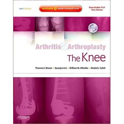 The Knee [With DVD]