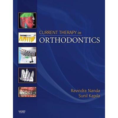 Current Therapy In Orthodontics