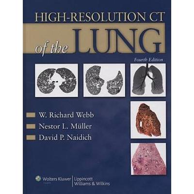 High-Resolution Ct Of The Lung