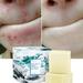 Shengshi Sea Salt Clear Soap Handmade Soap Pimple Pores Acne Remove Goat Milk Moisturizing Face Wash Skin Care Products 100g