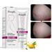 40g Stretch Mark Cream For Pregnancy Repair Scar Slack Line Abdomen Stretch Marks Cream