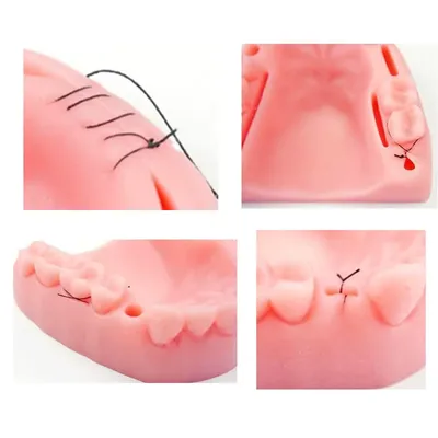 Kit de plaies dentaires pour dentiste modèle fuchsia kit de suture buccale kit de formation à la