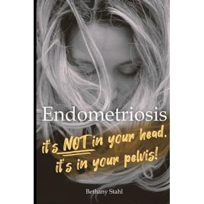 Endometriosis: it's not in your head, it's in your pelvis