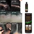 Shampooing anti-pelliculaire nourrissant efficace améliore la qualité des cheveux traitement