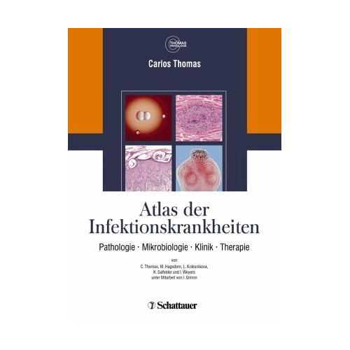 Atlas der Infektionskrankheiten – Carlos Herausgegeben:Thomas