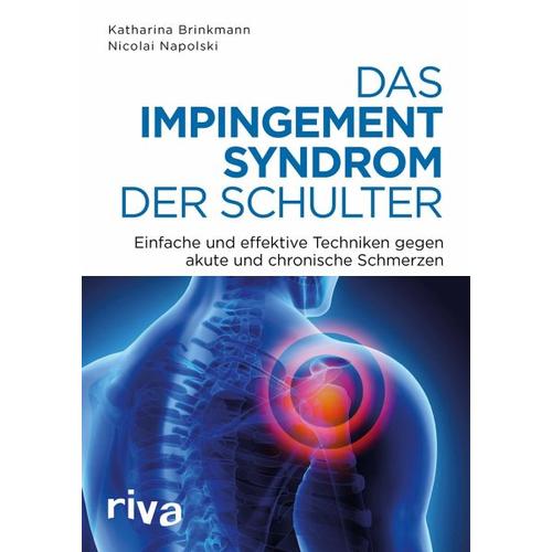 Das Impingement-Syndrom der Schulter – Nicolai Napolski, Katharina Brinkmann