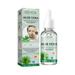 (Buy 2 Get 1 Free)30mlAloe Hydrating Moisturizing Serum- Aloe- Facial Serum- Soothing Hydrating Beauty Therapy- Anti-Aging Anti-Wrinkle Essential- Oil Skincare-_NEW-PPHHD