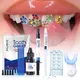 Hot Teeth Decorations 37% Acid Etching Gel Light Cure Adhesive Flowable Composite Professional Diy