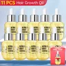 PURC 10PCS Hair Growth for Men Women Products Ginger Hair Oil Fast Grow Serum Anti Loss Regrowth