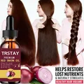 Onion Black Seed Hair Oil Spray for Natural Hair Care and Growth Prevent Hair Loss Biotin Fast Hair