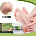 Urea cream hand foot care anti-dry Cracked exfoliation Removal Dead Skin Softening moisturizing