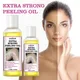 30ML Extra Strong Yellow Peeling Oil Whitening Lighten Elbows Knees Hands Even Skin Tone Whiten Skin
