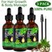 Aliver Black Castor Oil Cold Pressed 3 Pack Body Massage Oil - Detoxification - Reduce Inflammation - Hair Growth - Dry Skin Relief - Aromatherapy & Relaxation 100% Pure Jamaican Black Castor Oil