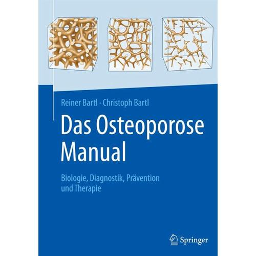 Das Osteoporose Manual – Christoph Bartl, Reiner Bartl