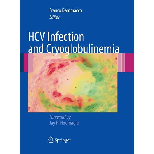 Hcv Infection And Cryoglobulinemia, Kartoniert (TB)