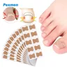 Pexmen 10/20/50/100/200Pcs adesivi per la correzione dell'unghia del piede incarnita Patch per il