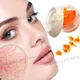 Facial Varicose Vein Essence Anti Redness Spider Vein Remover Advanced Treatment Clearer Skin Veins
