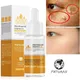 Nicotinamide Whitening Freckles Serum Dark Spot Remover Vitamin C Lightening Melanin Blemish