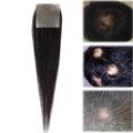 Front Hairline Hair Patch, Full Skin Base Cover-Up Hair Patches Pieces Human Hair Topper for Hair Loss or Thin Hair(2.5 * 2.5cm)