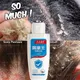 Natürliche Shampoo Anti-schuppen Ätherisches Öle Schnelle Loszuwerden Anti Schuppen Haarausfall