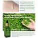 BRYLEE Acne Treatment Green Tea Essence Anti-acne Essence Mild And Non-irritating Anti-acne Anti-acne Print Essence