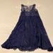 Anthropologie Dresses | Anthropologie Lace Dress | Color: Blue | Size: S