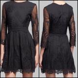 Anthropologie Dresses | Anthropologie - Dolce Vita - Valentina Lace Dress | Color: Black | Size: L