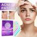 Gzwccvsn Hydrocolloid Acne Patch for Face Stra Acne Patch Holographic Acnes Patch With Salicylic And TeaTree Oil Facial Acnes Patch 180 Piece Of Acnes Patch Water Colloidal Acnes Patch