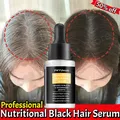 Sérum anti-noircissement des cheveux essence anti-gris traitement des cheveux blancs à noirs soin