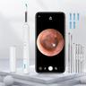 smart visual pulitore dell'orecchio bastone dell'orecchio endoscopio earpick camera otoscopio pulitore dell'orecchio rimozione del cerume orecchio picker strumento di rimozione del cerume