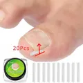 20pcs Ingrown Toenail Correction Tool Invisible Ingrown Toe Nail Treatment Pad Groove Straightening