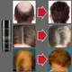 Toppik Hair Loss Building Fibers Hair Fibers Regrowth Powders Keratin Applicator Hair Growth