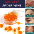 Anti-Spider Vein Essense Face Redness Removal Red Blood Silk Repair Essential Oil Sensitive Skin