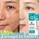 Effective Whitening Freckle Cream Remove Melasma Melanin Dark Spots Cream Moisturizing Nourishing