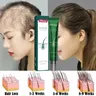 2023 Biotin Fast Hair Growth Oil Hair Regrowth Serum Hair Thinning Treatment Growth Liquid Anti-Hair