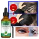 Hair Thickening Castor Oil for Hair Growth Treatment Preventing Baldness Anti Hair Loss Roots