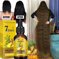 Fast Hair Growth Ginger Growth Hair Oil Treatment Anti Hair Loss Men Women Scalp Treatment Serum