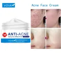 VOVA Acne Face Cream Treatment Acne Lighten Acne Marks Oil Control Anti-inflammatory Whitening