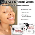 Kojic Acid Retinol Cream Skin Whitening Cream Remove Dark Spots Anti Aging Brighten Moisturizing