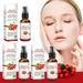 WNG Organic Rosehip Oil Skin Care Facial Hydrating Moisturizing Rejuvenating Female 30ml