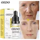 OEDO-Sérum blanchissant et éclaircissant pour le visage essence pour points lumineux hydratant