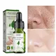 Pore Shrink Face Serum Green Tea Oil Control Remove Dark Spots Improve Acne Blackheads Dry Skin Firm