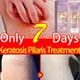 Moisturizing Body Scrub Repairing Keratin Hyperplasia Removing Strawberry Legs Repairing Nourishing