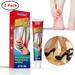 RoseHome 3 Pack Herbal Foot Heel Pain Ointment Rheumatism & Arthritis Pain Ointment Foot Sprain Analgesic Cream