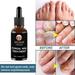 50ml Fungal Nail Treatment Essential Oil Hand & Foot Whitening Toe Nail Fungus Removal Infection Feet Care Polish Hand Nail Gel
