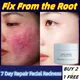 Repair Facial Redness Cream 7 Day Soothing Redness Repair Skin Rosacea Red Blood Improve Sensitive