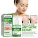 Jayusing anti-acne essence dilutes acne acne marks closed mouth moisturizing facial skin repair acne essence