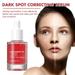 Dark Spot Correcting Serum Face Niacinamide Serum Dark Spot Correcting Serum for Women Face Moisturizing Hyperpigmentation (1PCS 30ML)