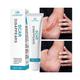 Scar Removal Cream Repair Stretch Marks Burn Acne Surgical Acne Scar Ointment Herbal Treatment Gel Whitening Beauty Health Care